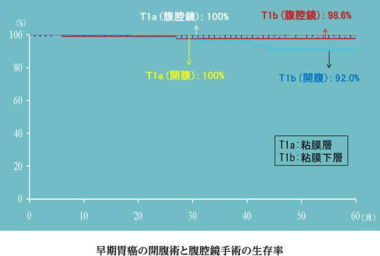 早期胃癌の開腹術と腹腔鏡手術の生存率