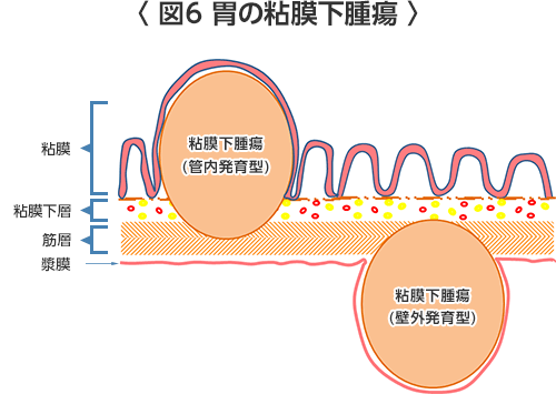 ケン 腫瘍 クルー ベルグ