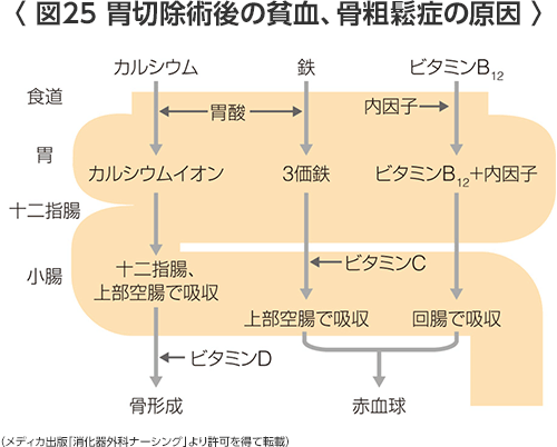 ダンピング 症候群 看護 計画