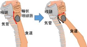 Cervical06_03.jpg
