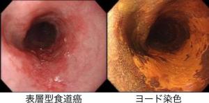 Thoracic01_01.jpg