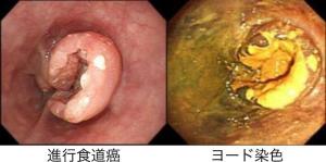 Thoracic01_02.jpg