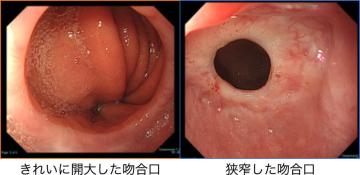 Thoracic05_03.jpg