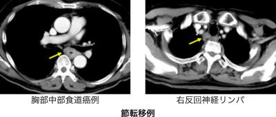 Thoracic01_03.jpg