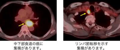 Thoracic01_04.jpg