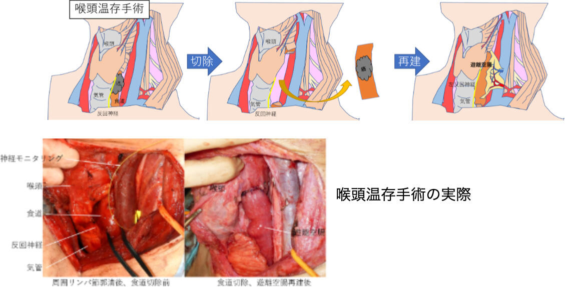 Cervical06_04.jpg