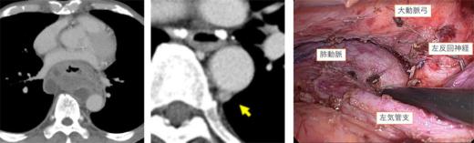 Thoracic05_02.jpg