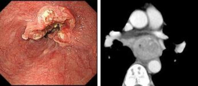 Thoracic00_02.jpg