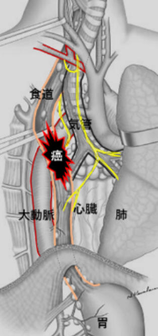Thoracic00_01.jpg