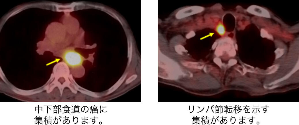 Thoracic01_04.jpg