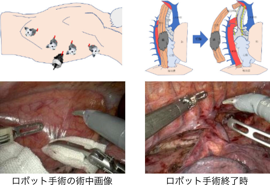 Thoracic03_02.jpg