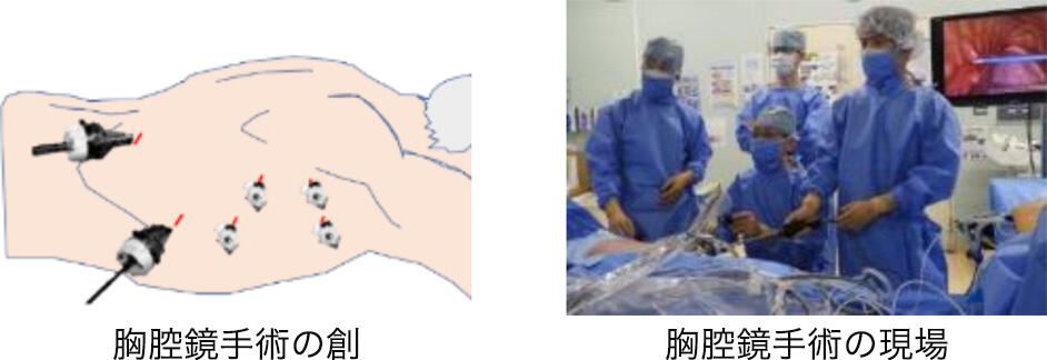 Thoracic03_03.jpg