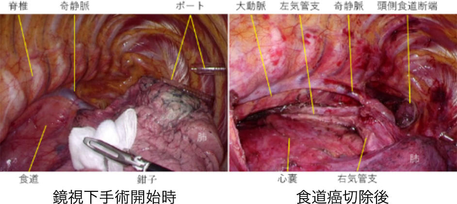 Thoracic03_04.jpg