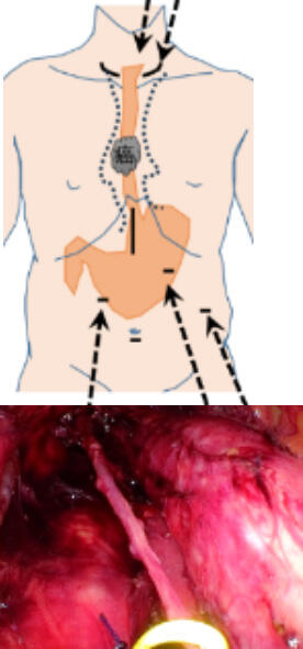 Thoracic03_05.jpg