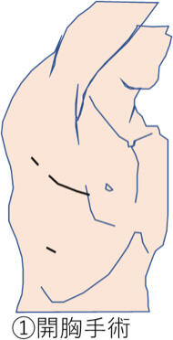 Thoracic03_06.jpg