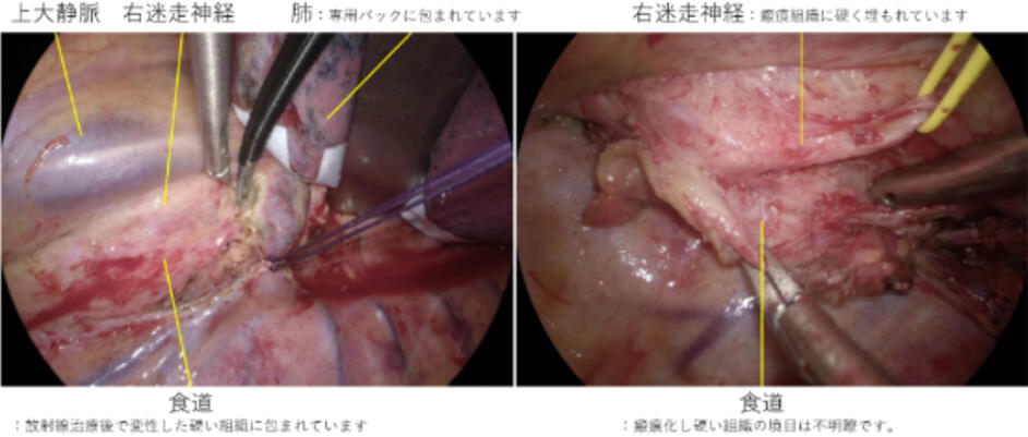 Thoracic03_07.jpg