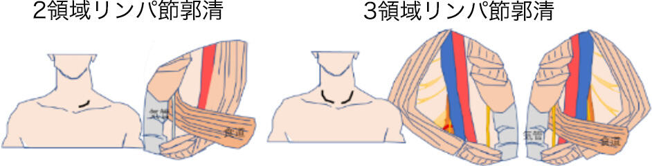 Thoracic03_08.jpg