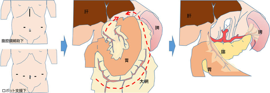 Thoracic03_09.jpg
