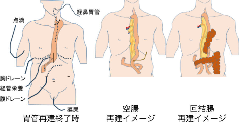 Thoracic03_11.jpg