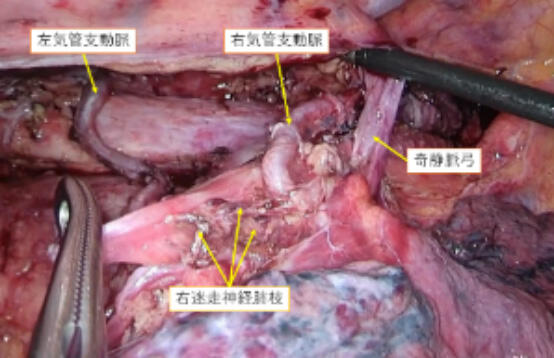 Thoracic05_01.jpg